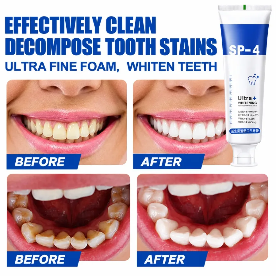 Ultra+ Whitening Toothpaste Brightening & Stain Removal β photo 5