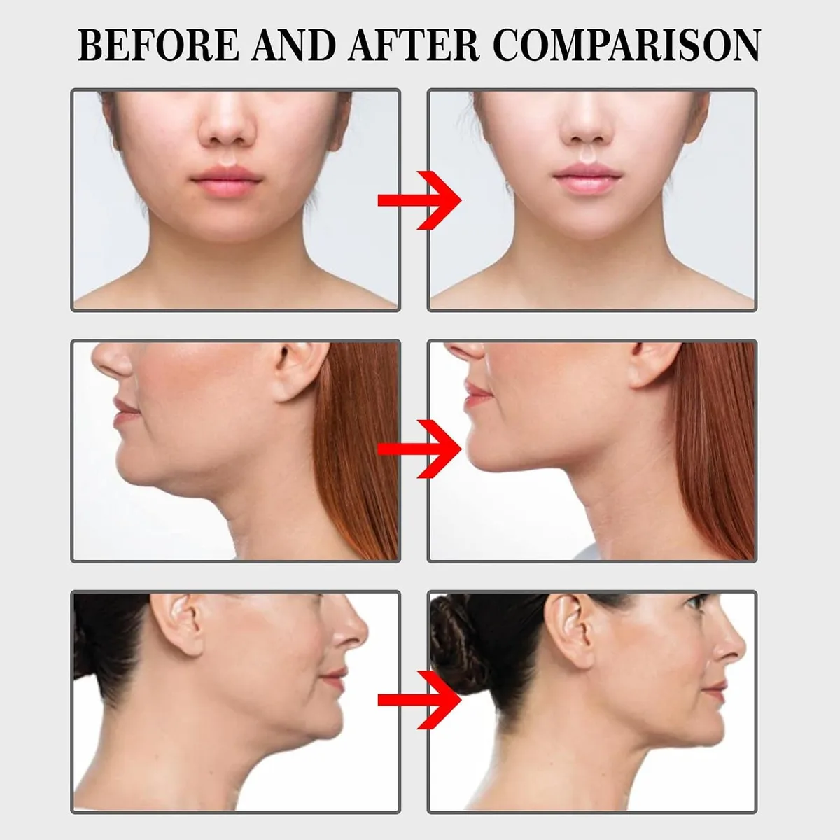 100-Piece Face Lifting Tape Kit β photo 6