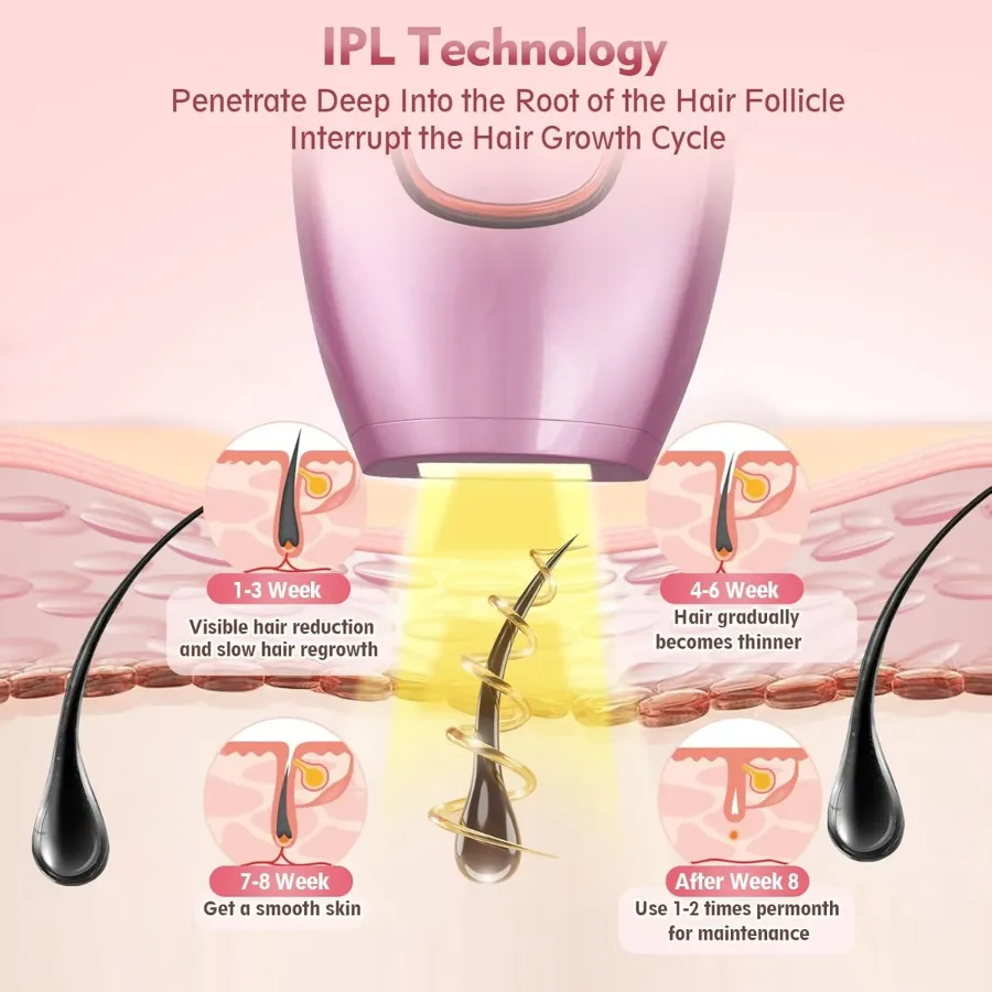 IPL Hair Removal Devices, Hair Removal, Laser Permanent Hair Removal, Laser Hair Remover, - Pink — photo 7