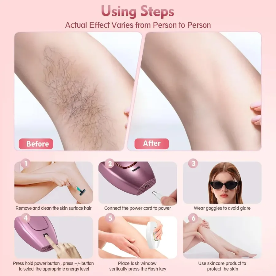 IPL Hair Removal Devices, Hair Removal, Laser Permanent Hair Removal, Laser Hair Remover, - Black β photo 4