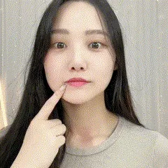 Lip Augmentation Device β photo 7