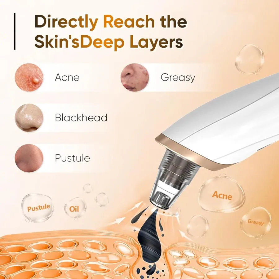 5 in 1 Rechargeable Blackhead Remover Facial Pore Cleaner Deep Cleaning β photo 2