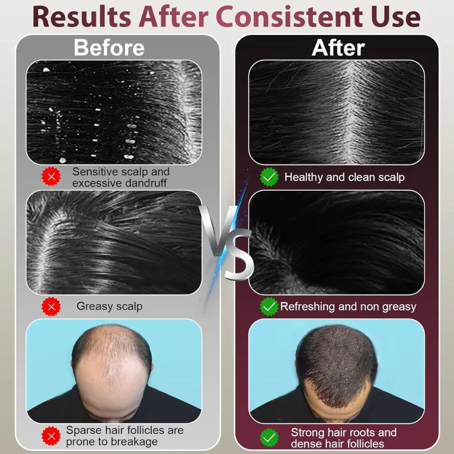 Laser Therapy Hair Growth Comb – Electric Scalp Massager & Hair Oil Applicator Waterproof — photo 5